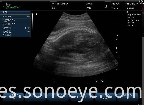 C10 Color Doppler Ultrasound System For Hostipal